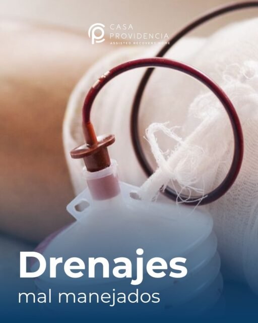 💧 Los drenajes también necesitan cuidado especializado.
Un mal manejo puede poner en riesgo tu recuperación, causar infecciones o complicaciones innecesarias. ⚠
Porque tu salud merece atención profesional en cada detalle. 💙
